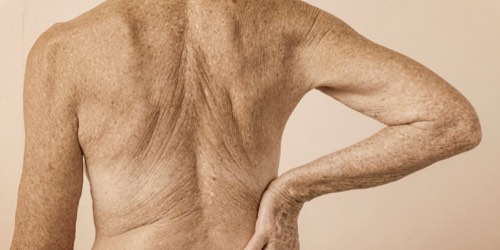 Close up of an elderly persons skin Close up of an elderly persons skin